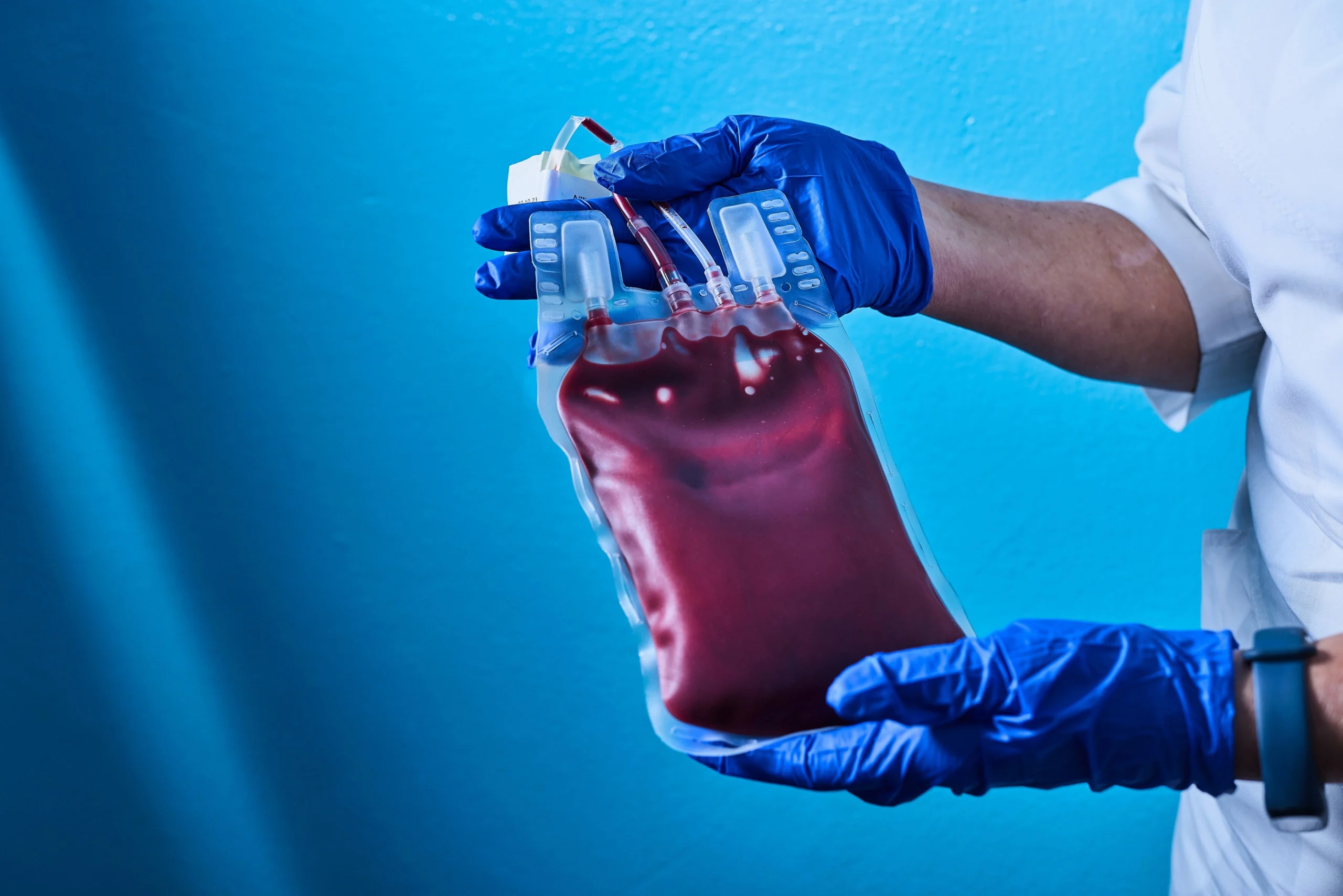 Sangue dourado (Rh nulo): por que só 50 pessoas têm e como a ciência quer fabricar o tipo sanguíneo mais raro do mundo Apenas 50 pessoas no mundo têm este sangue raro — e a ciência quer fabricá-lo