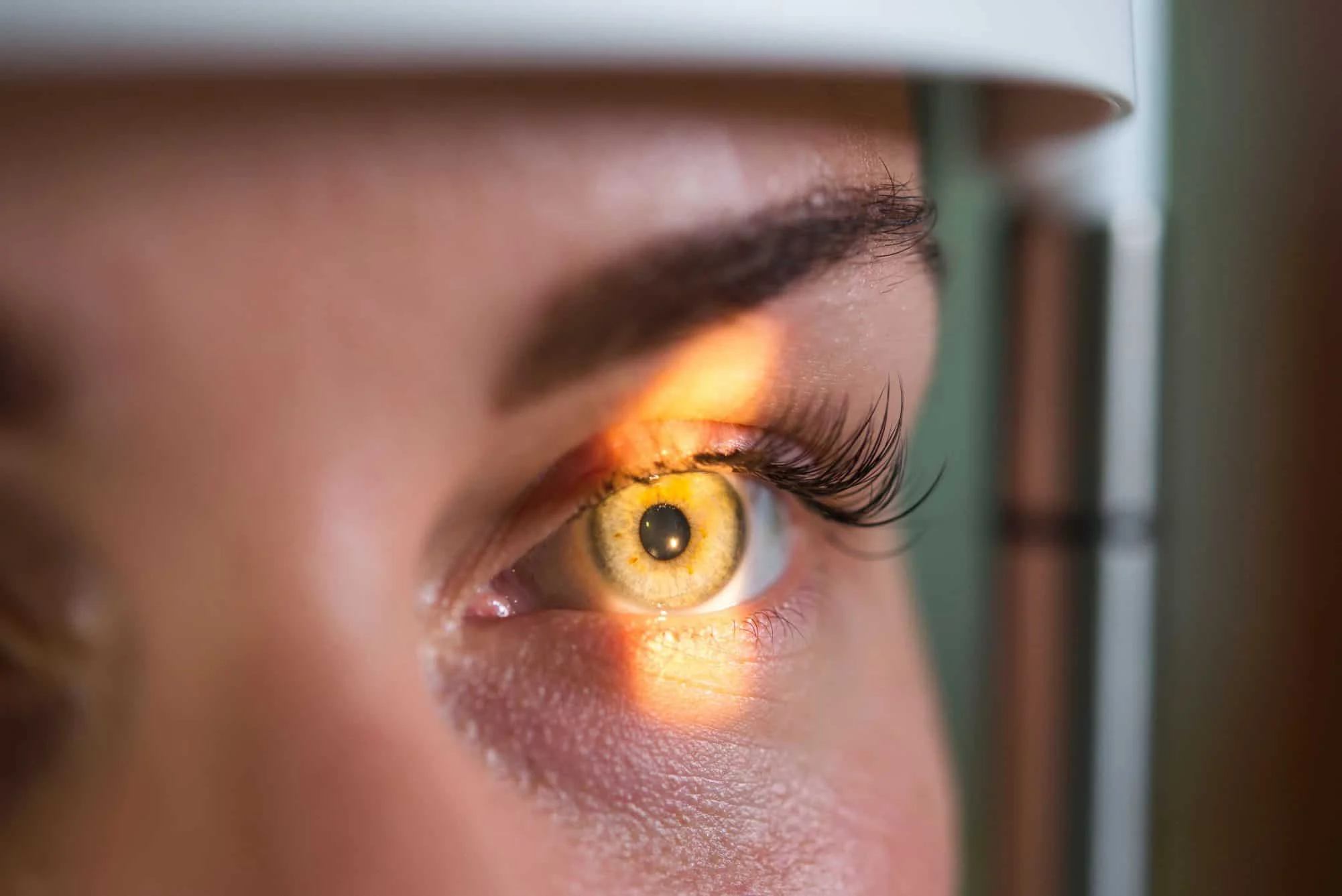 Ambliopia em adultos: anestesia temporária da retina do MIT mostra recuperação de resposta visual em estudo publicado na Cell Reports Nova abordagem pode restaurar visão em olho com ambliopia