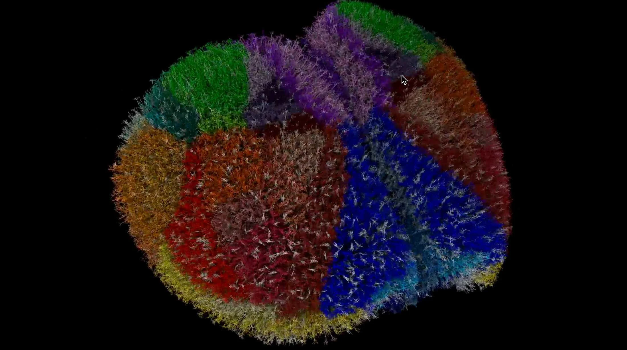 Simulação cerebral permite testar Alzheimer e epilepsia sem tecido real no futuro