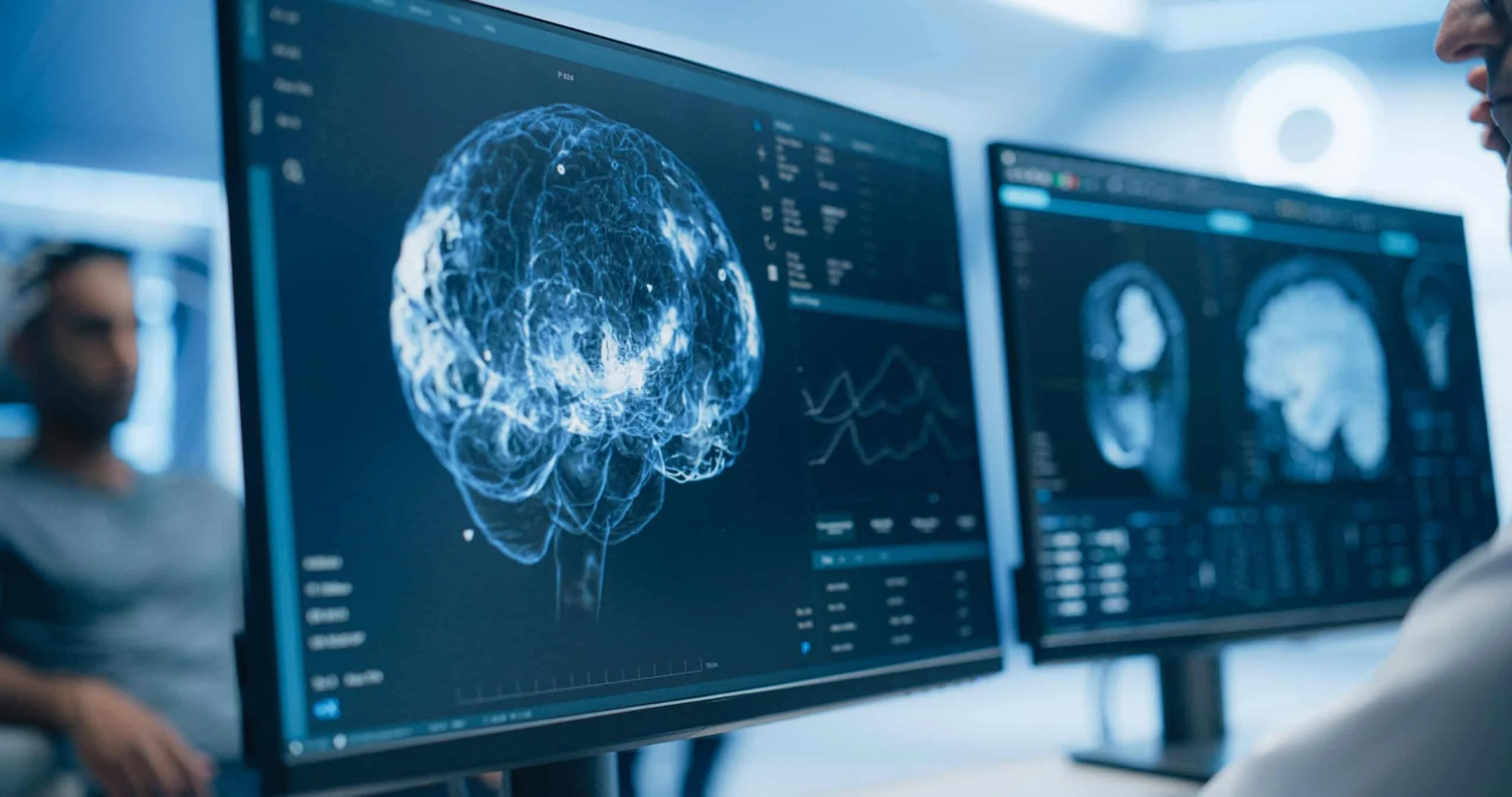 Mapas cerebrais podem transformar a compreensão do autismo